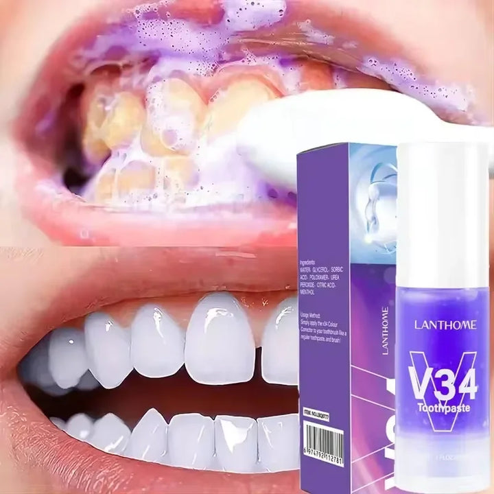 Teeth Whitening Kit