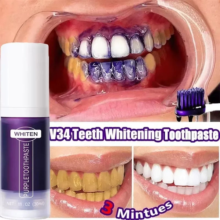 Teeth Whitening Kit
