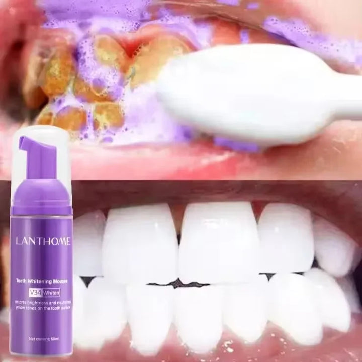 Teeth Whitening Kit