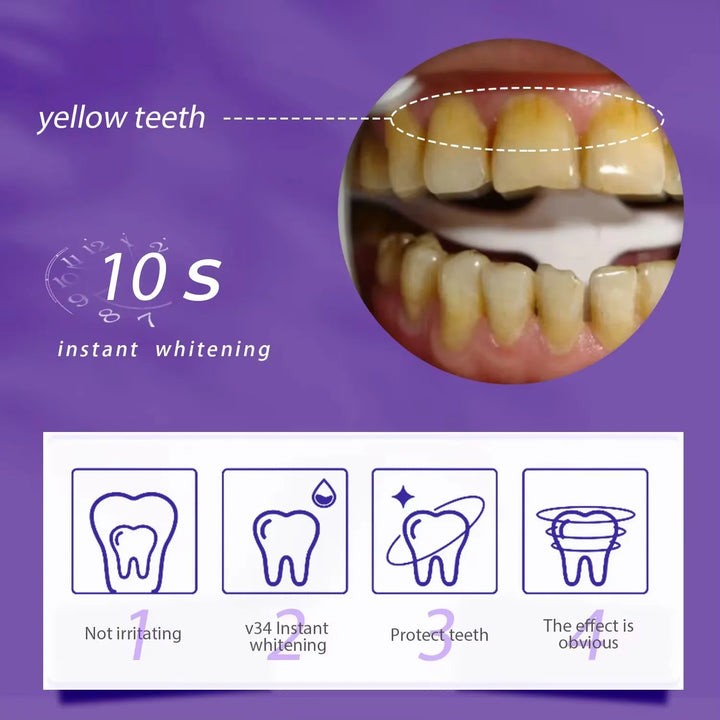 Teeth Whitening Kit