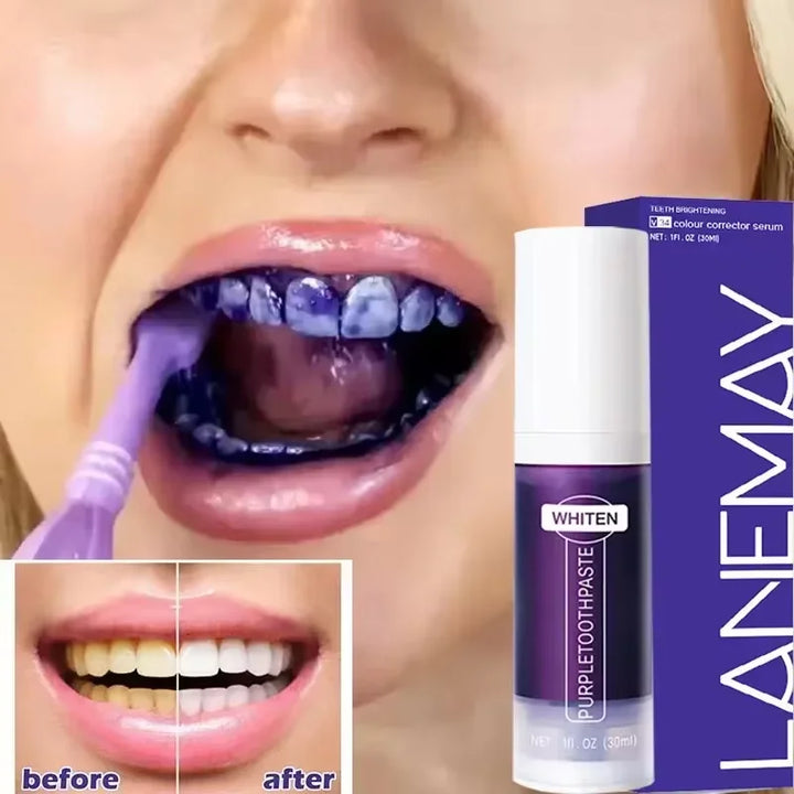 Teeth Whitening Kit