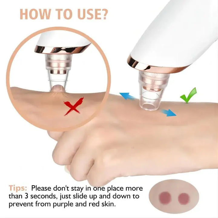 Blackhead Remover Pro